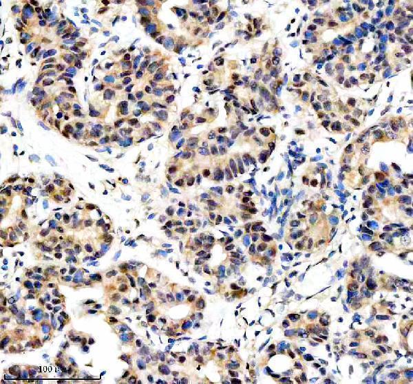  IHC analysis of DKC1 using anti-DKC1 antibody (A01535-2)
