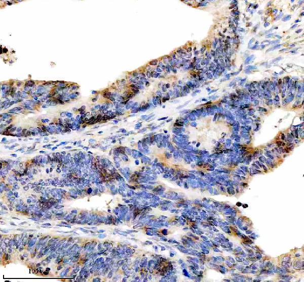  IHC analysis of DKC1 using anti-DKC1 antibody (A01535-2)