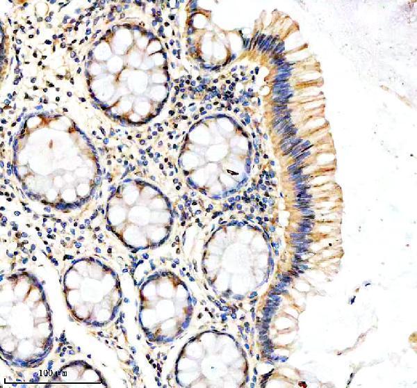a01535 2 dkc1 primary antibodies ihc testing 4