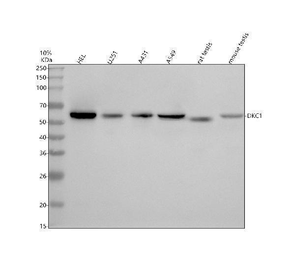  Western blot analysis of DKC1 using anti-DKC1 antibody (A01535-2)