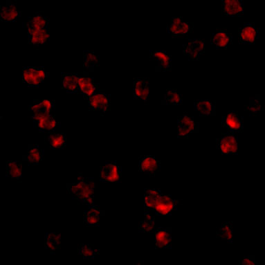 Immunofluorescence of TLR8 in Daudi cells with TLR8 antibody at 10 μg/mL