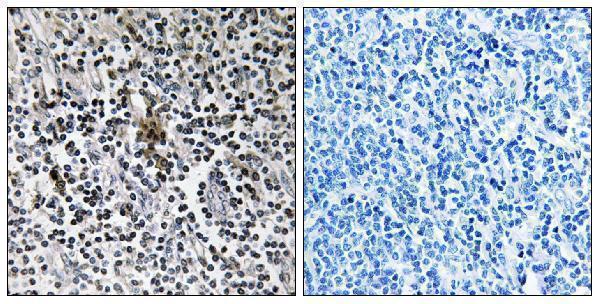 Immunohistochemistry analysis of paraffin-embedded human tonsil tissue, using RPS3 Antibody