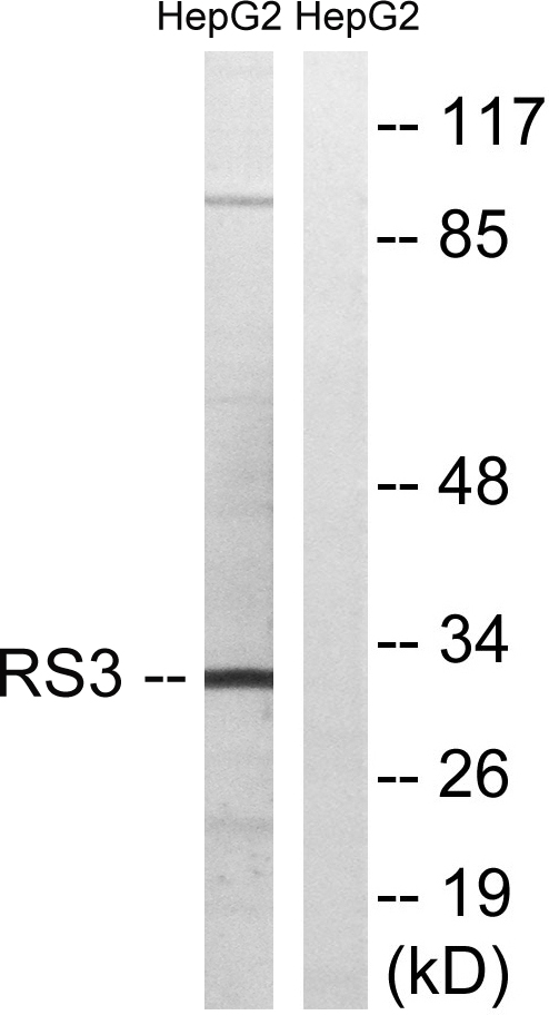 Western blot analysis of lysates from HepG2 cells, using RPS3 Antibody