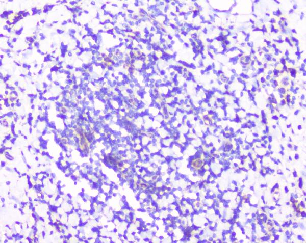 IHC analysis of RPS3 using anti-RPS3 antibody (A01542-2). RPS3 was detected in paraffin-embedded section of human tonsil tissues. Heat mediated antigen retrieval was performed in citrate buffer (pH6, epitope retrieval solution) for 20 mins. The tissue section was blocked with 10% goat serum. The tissue section was then incubated with 1μg/ml rabbit anti-RPS3 Antibody (A01542-2) overnight at 4°C. Biotinylated goat anti-rabbit IgG was used as secondary antibody and incubated for 30 minutes at 37°C. The tissue section was developed using Strepavidin-Biotin-Complex (SABC)(Catalog # SA1022) with DAB as the chromogen.