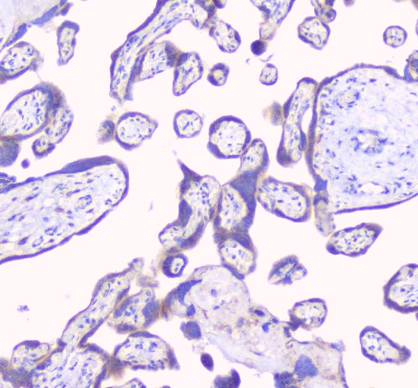 IHC analysis of RPS3 using anti-RPS3 antibody (A01542-2). RPS3 was detected in paraffin-embedded section of human placenta tissues. Heat mediated antigen retrieval was performed in citrate buffer (pH6, epitope retrieval solution) for 20 mins. The tissue section was blocked with 10% goat serum. The tissue section was then incubated with 1μg/ml rabbit anti-RPS3 Antibody (A01542-2) overnight at 4°C. Biotinylated goat anti-rabbit IgG was used as secondary antibody and incubated for 30 minutes at 37°C. The tissue section was developed using Strepavidin-Biotin-Complex (SABC)(Catalog # SA1022) with DAB as the chromogen.