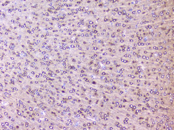 IHC analysis of RPS3 using anti-RPS3 antibody (A01542-2). RPS3 was detected in paraffin-embedded section of mouse brain tissues. Heat mediated antigen retrieval was performed in citrate buffer (pH6, epitope retrieval solution) for 20 mins. The tissue section was blocked with 10% goat serum. The tissue section was then incubated with 1μg/ml rabbit anti-RPS3 Antibody (A01542-2) overnight at 4°C. Biotinylated goat anti-rabbit IgG was used as secondary antibody and incubated for 30 minutes at 37°C. The tissue section was developed using Strepavidin-Biotin-Complex (SABC)(Catalog # SA1022) with DAB as the chromogen.
