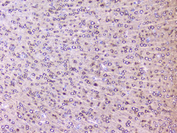 a01542 2 rps3 primary antibodies ihc testing 5