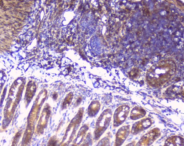 IHC analysis of RPS3 using anti-RPS3 antibody (A01542-2). RPS3 was detected in paraffin-embedded section of mouse intestine tissues. Heat mediated antigen retrieval was performed in citrate buffer (pH6, epitope retrieval solution) for 20 mins. The tissue section was blocked with 10% goat serum. The tissue section was then incubated with 1μg/ml rabbit anti-RPS3 Antibody (A01542-2) overnight at 4°C. Biotinylated goat anti-rabbit IgG was used as secondary antibody and incubated for 30 minutes at 37°C. The tissue section was developed using Strepavidin-Biotin-Complex (SABC)(Catalog # SA1022) with DAB as the chromogen.