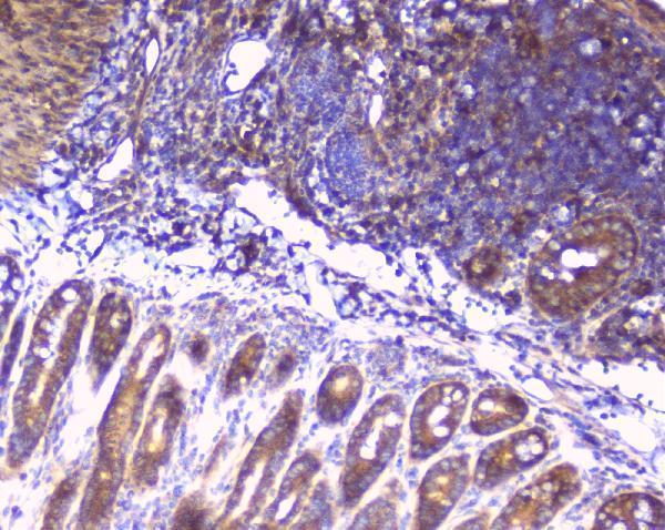 a01542 2 rps3 primary antibodies ihc testing 6