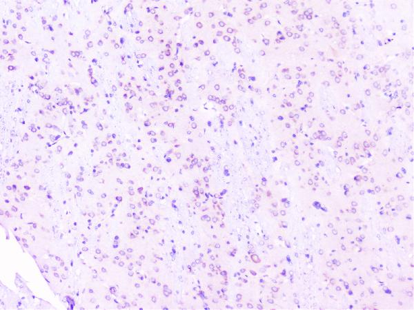 IHC analysis of RPS3 using anti-RPS3 antibody (A01542-2). RPS3 was detected in paraffin-embedded section of rat brain tissues. Heat mediated antigen retrieval was performed in citrate buffer (pH6, epitope retrieval solution) for 20 mins. The tissue section was blocked with 10% goat serum. The tissue section was then incubated with 1μg/ml rabbit anti-RPS3 Antibody (A01542-2) overnight at 4°C. Biotinylated goat anti-rabbit IgG was used as secondary antibody and incubated for 30 minutes at 37°C. The tissue section was developed using Strepavidin-Biotin-Complex (SABC)(Catalog # SA1022) with DAB as the chromogen.