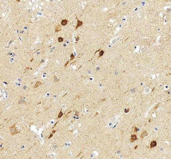 a01543 1 map1lc3a primary antibodies ihc testing 7