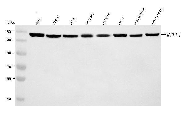  Western blot analysis of RTEL1 using anti-RTEL1 antibody (A01544-2)