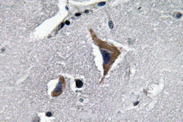 a01545 oxt primary antiboties ihc testing 2