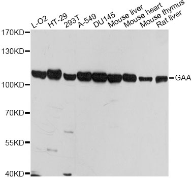 Western blot analysis of extracts of various cell lines, using GAA  antibody  at 1:1000 dilution