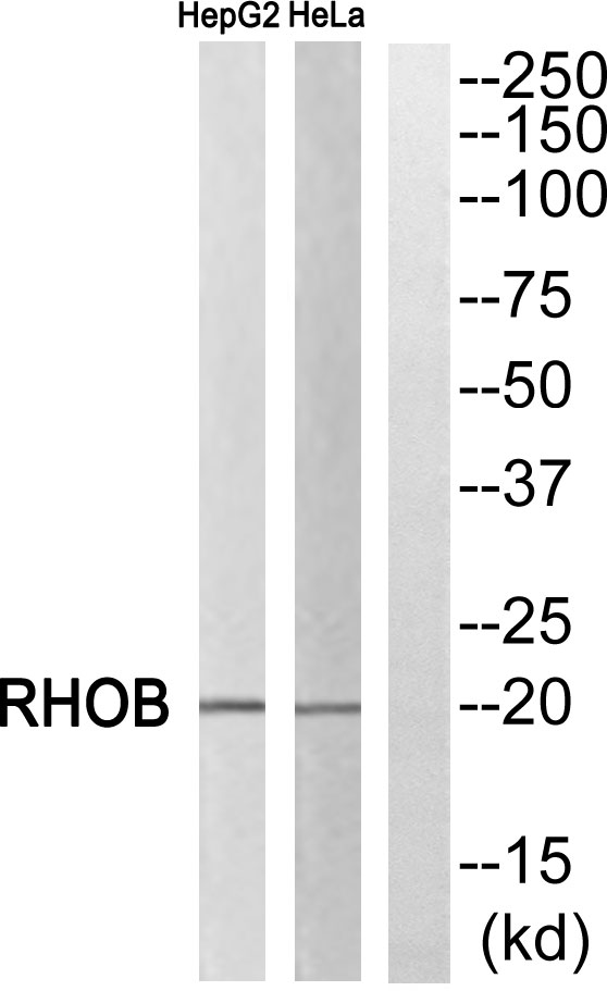 Western blot analysis of RHOB Antibody