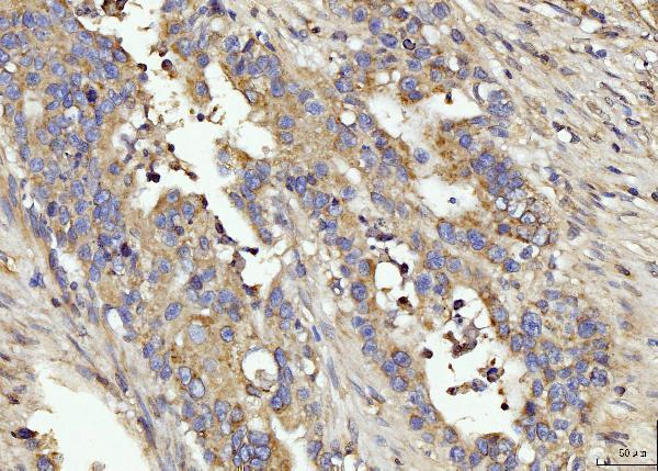a01551 1 bin1 primary antibodies ihc testing 2