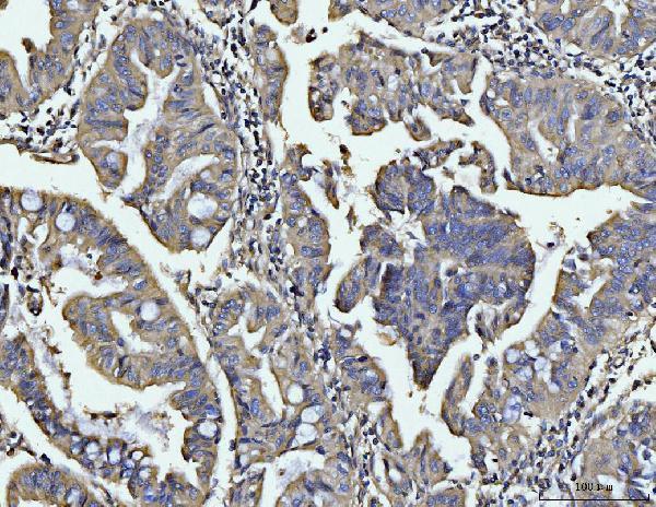 a01551 1 bin1 primary antibodies ihc testing 3