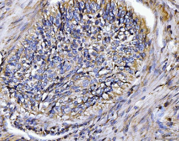 a01551 1 bin1 primary antibodies ihc testing 4