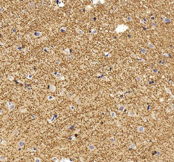 a01551 1 bin1 primary antibodies ihc testing 5