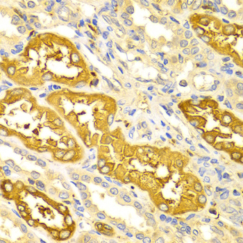 a01551 bin1 primary antiboties ihc testing 2