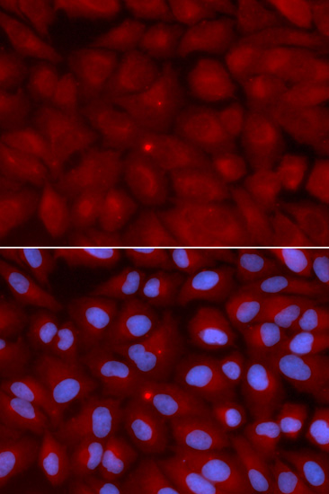 a01551 bin1 primary antiboties ihc testing 3