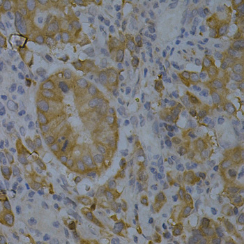 a01551 bin1 primary antiboties ihc testing 4