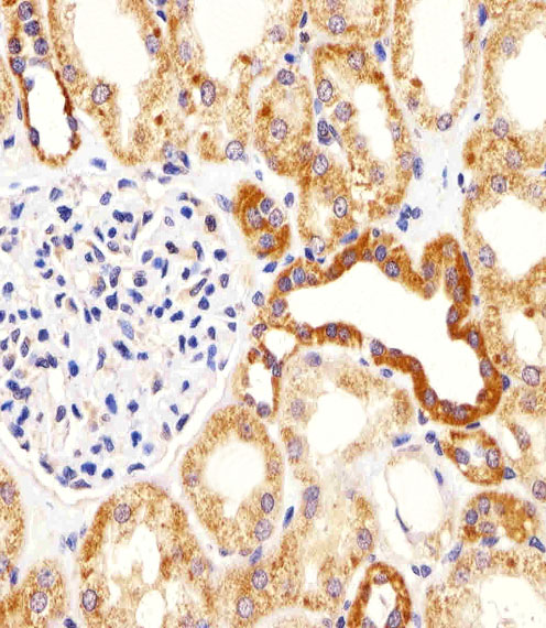 Immunohistochemical analysis of paraffin-embedded H