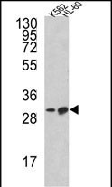 Western blot analysis of BCL2L11 Antibody (Center) in K562, HL-60 cell line lysates (35ug/lane)