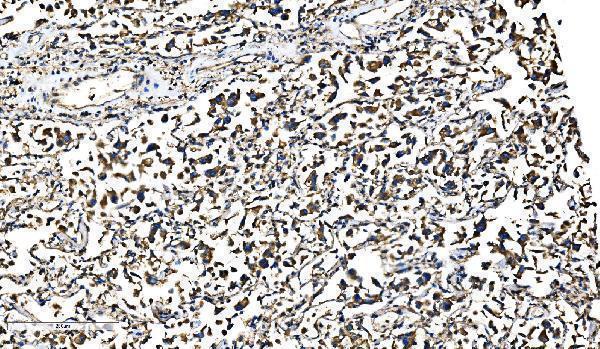  IHC analysis of Bim/BCL2L11 using anti-Bim/BCL2L11 antibody (A01552-4)