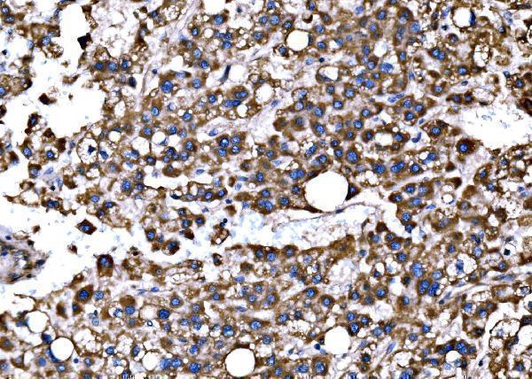  IHC analysis of Bim/BCL2L11 using anti-Bim/BCL2L11 antibody (A01552-4)
