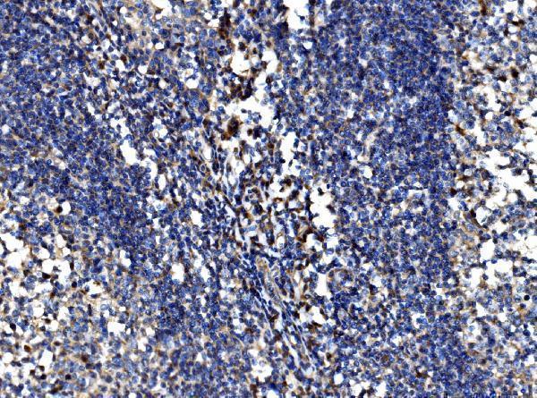 a01552 4 bcl2l11 primary antibodies ihc testing 4
