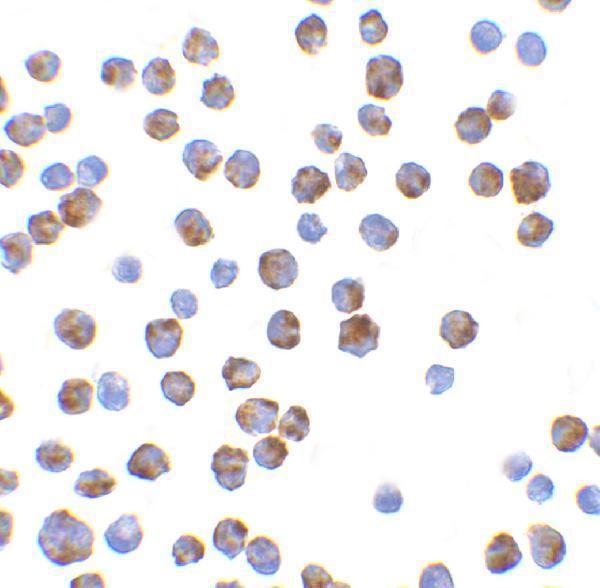 a01552 bcl2l11 primary antibodies icc testing 5