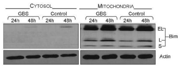 a01552 bcl2l11 primary antibodies wb testig 11