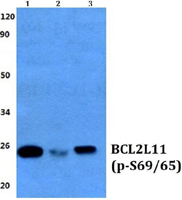 Western blot (WB) analysis of p-Bim (S69/S65) polyclonal antibody at 1:500 dilution
Lane1:HEK293T whole cell lysate
Lane2:Raw264