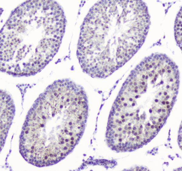 a01554 1 smc6l1 primary antibodies ihc testing 2