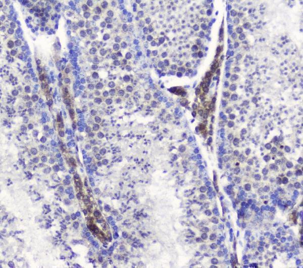 a01554 1 smc6l1 primary antibodies ihc testing 4