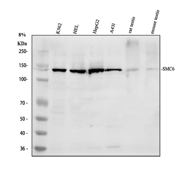 a01554 1 smc6l1 primary antibodies wb testing 1