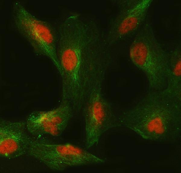  IF analysis of SMC6 and Tubulin beta using anti-SMC6 antibody (A01554-2) and anti-Tubulin beta antibody (M05613-4)