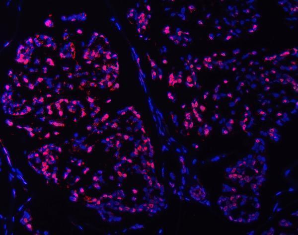 a01554 2 smc6 primary antibodies if testing 4