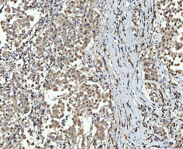  IHC analysis of SMC6 using anti-SMC6 antibody (A01554-2)