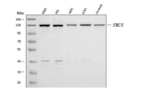  Western blot analysis of SMC6 using anti-SMC6 antibody (A01554-2)