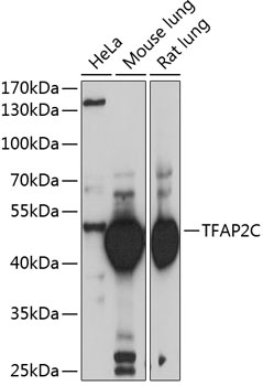 a01558 1 tfap2c primary antiboties wb testing 1