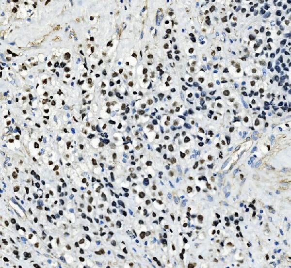  IHC analysis of AP2 Gamma/TFAP2C using anti-AP2 Gamma/TFAP2C antibody (A01558-2)