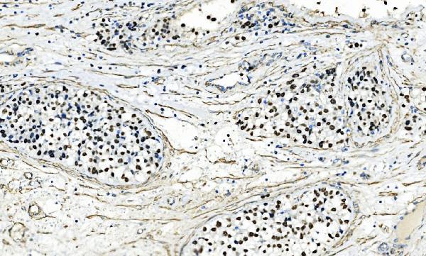  IHC analysis of AP2 Gamma/TFAP2C using anti-AP2 Gamma/TFAP2C antibody (A01558-2)