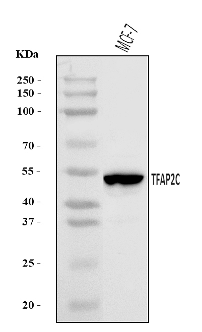  Western blot analysis of AP2 Gamma/TFAP2C using anti-AP2 Gamma/TFAP2C antibody (A01558-2)