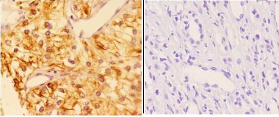 a01558 tfap2c primary antiboties ihc testing 2