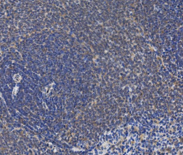 a01559 irak2 primary antibodies ihc testing 3