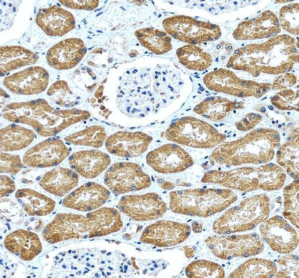 IHC analysis of IRAK2 using anti-IRAK2 antibody (A01559)