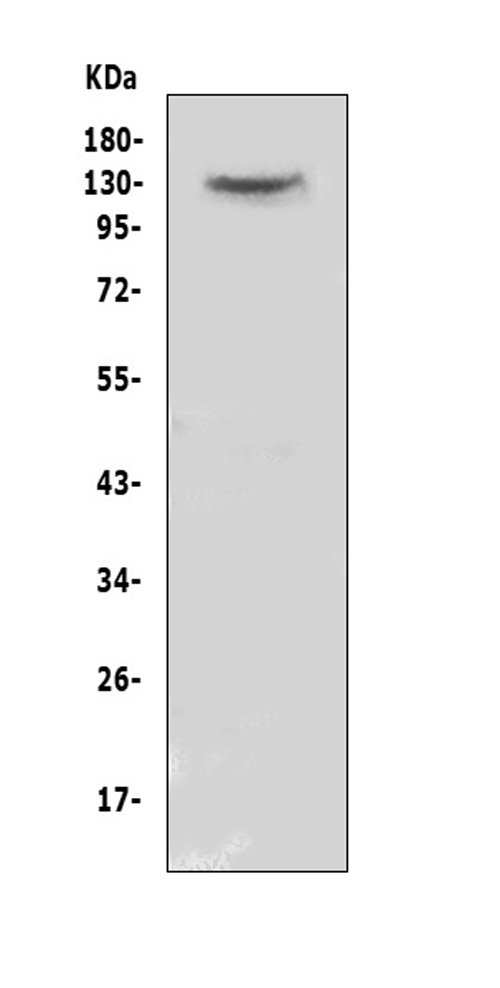 Western blot analysis of CACNA2D2 using anti-CACNA2D2 antibody (A01560-1). Electrophoresis was performed on a 5-20% SDS-PAGE gel at 70V (Stacking gel) / 90V (Resolving gel) for 2-3 hours. The sample well of each lane was loaded with 50ug of sample under reducing conditions. Lane 1: human MCF-7 whole cell lysate. After Electrophoresis, proteins were transferred to a Nitrocellulose membrane at 150mA for 50-90 minutes. Blocked the membrane with 5% Non-fat Milk/ TBS for 1.5 hour at RT. The membrane was incubated with rabbit anti-CACNA2D2 antigen affinity purified polyclonal antibody (Catalog # A01560-1) at 0.5 μg/mL overnight at 4°C, then washed with TBS-0.1%Tween 3 times with 5 minutes each and probed with a goat anti-rabbit IgG-HRP secondary antibody at a dilution of 1:10000 for 1.5 hour at RT. The signal is developed using an Enhanced Chemiluminescent detection (ECL) kit (Catalog # EK1002) with Tanon 5200 system. A specific band was detected for CACNA2D2 at approximately 130KD. The expected band size for CACNA2D2 is at 130KD.