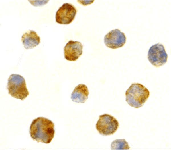 a01563 1 antxr1 primary antibodies icc testing 2